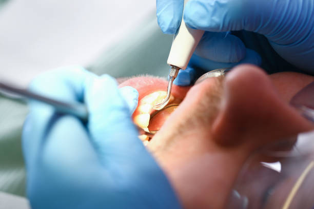 Best Emergency Treatment for Jaw Pain or Injury in Southworth, WA